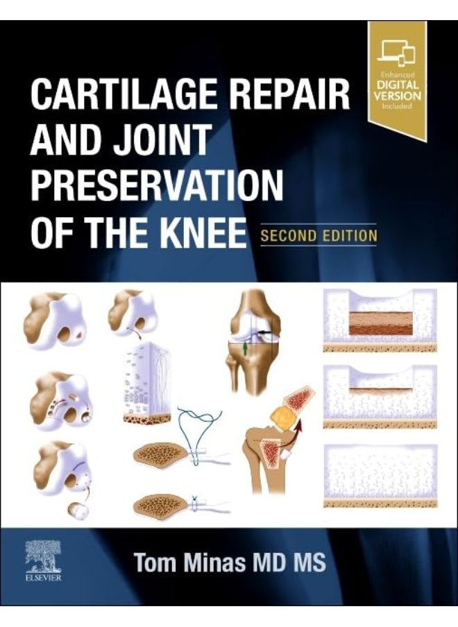 Cartilage Repair and Joint Preservation of the Kne 