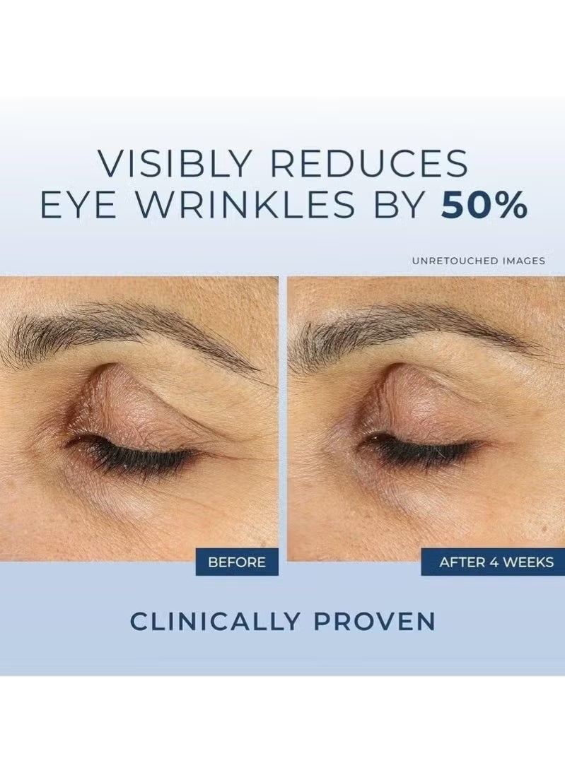 RoC Retinol Correxion Under Eye Cream for Dark Circles & Puffiness, Daily Wrinkle Cream, Anti Aging Line Smoothing Skin Care Treatment for Women and Men, 0.5 oz (Packaging May Vary) - Image 3