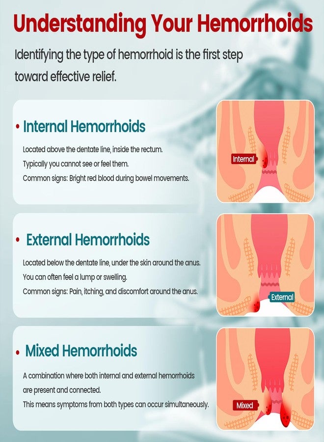 SERYNTH Hemorrhoid & Fissure Ointment, Hemorrhoid Treatment and Hemorrhoid Cream, Fast Acting Relief of Pain, Swelling, Burning, and Itching (0.7 oz. - Image 5