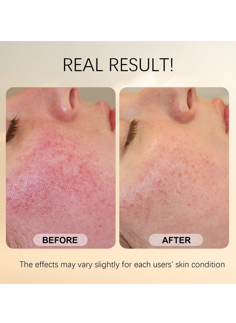 Selirxy Rice Face Mask 100g - Gentle Exfoliating Face Scrub with Rice Bran & Powder for Skin Brightening, Deep Hydration, Smooth Texture & Deep Cleansing for All Skin Types - Image 5