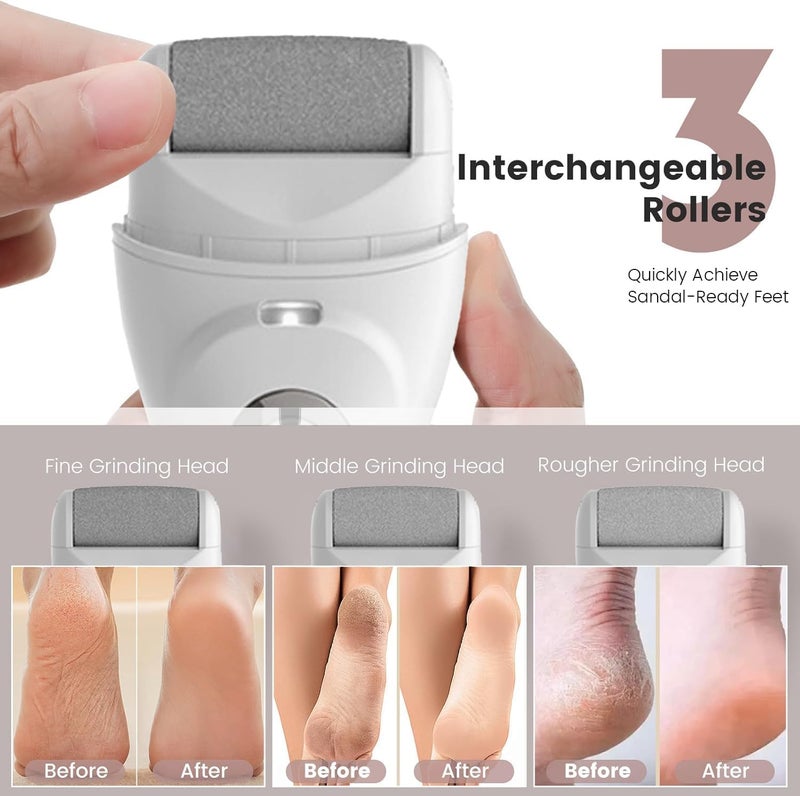 AccLoo Electric Foot Callus Remover with LED Light & Battery Display, 3-Speed Pedicure Machine with 3 Roller Heads, USB Fast Charging, Includes 10 Accessories, for Dead, Hard, Cracked Skin - Image 4