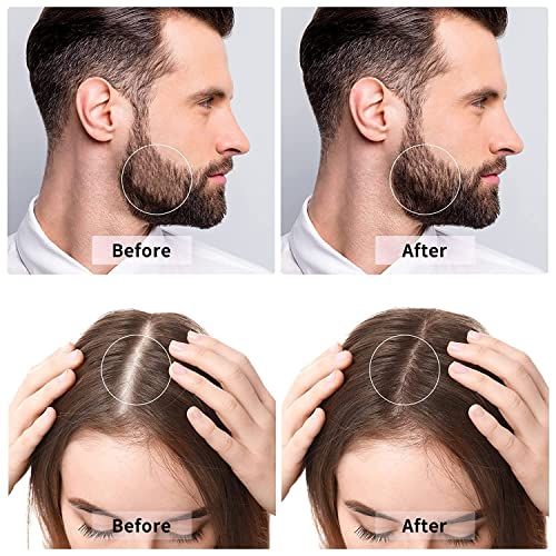BHUMLO Derma Roller for Hair and Beard Regrowth - 540 Micro 0.5mm Titanium Alloy Needles - Reduces Fall & Stimulates Follicles - Safe, Effective, Easy to Use - Skin Care for Men and Women - Image 2