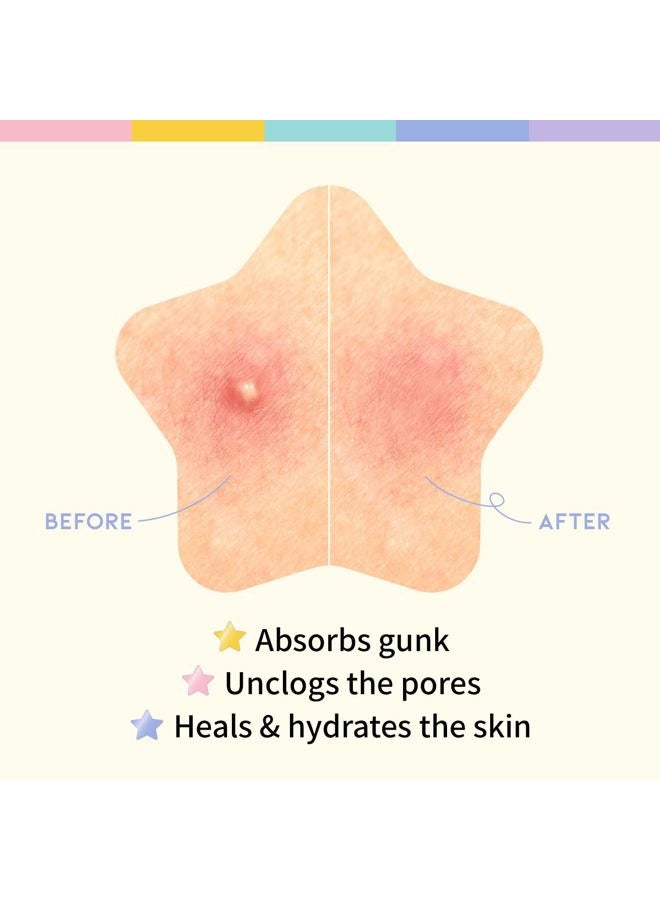 #OOTD Star-shaped Hydrocolloid Acne/Pimple patch with 5 Pastel Color/Niacinamide & Ceramide Formula: Hydrocolloid Pimple Patches, Ideal for Blemish Spots (80 Count) - Image 5