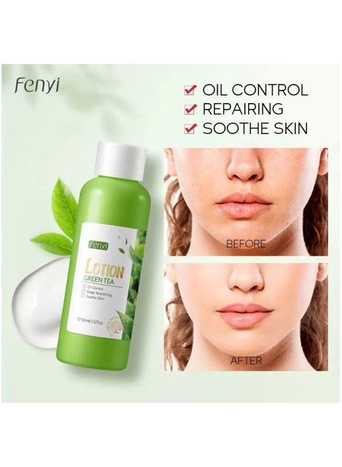 فيني لوشن الشاي الأخضر 100 مل - Image 4