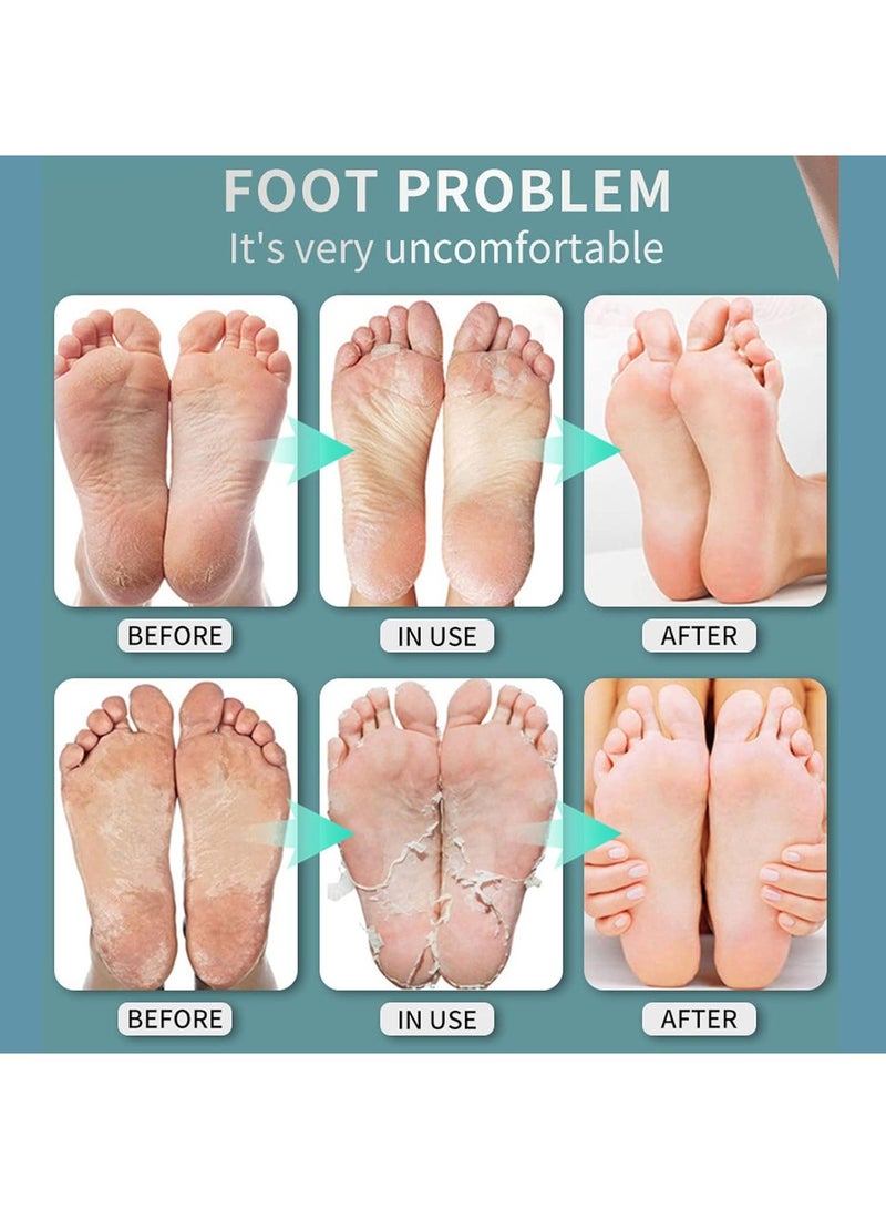 DubaiGallery Foot Care Spray Inhibits Beriberi Deodorizes Relieves Itching Peeling Dryness Ulceration Moisturizing Healthy Skin Care 30ml - Image 3