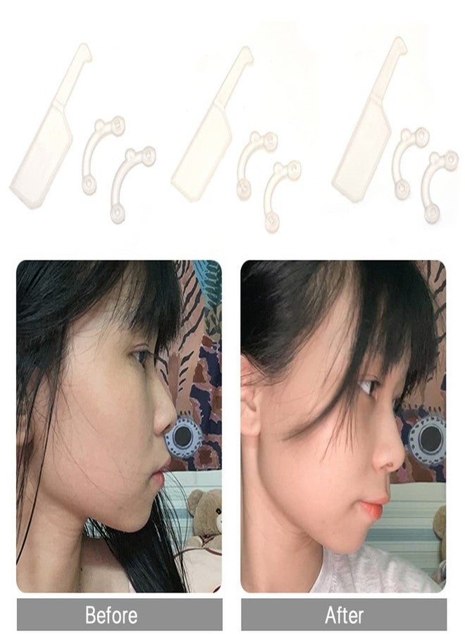 VANANA 3 Sizes Invisible Nose Lifter, Soft Silicone Nose Sharper Straightening Nose Up Corrector Tool, Comfortable Easy Install Removable (White) - Image 4