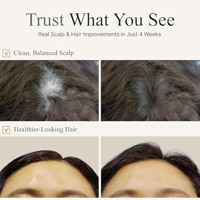 TS GOLD PLUS SHAMPOO | HAIR LOSS SHAMPOO WITH BIOTIN, GOLD EXTRACT & NIACINAMIDE | SCALP CIRCULATION & VOLUME CARE | SULFATE-FREE KOREAN HAIR CARE FOR THINNING HAIR (17.6 FL OZ / 500ML) - Image 3