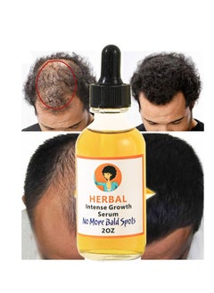 Herbal Hair Growth Oil And Serum  Dry Scalp Treatment, Hair Thickening Products for Women, Hair Loss Essential Oils For Diffuser 2OZ