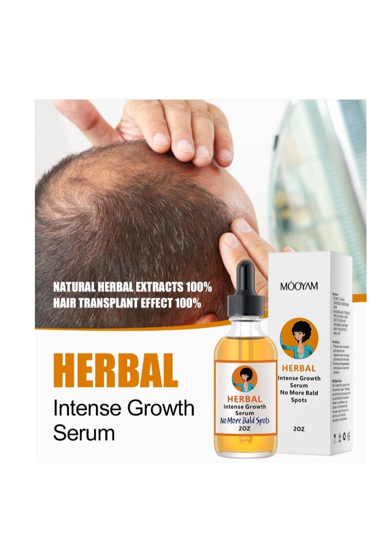 MOOYAM - Herbal Hair Growth Oil And Serum  Dry Scalp Treatment, Hair Thickening Products for Women, Hair Loss Essential Oils For Diffuser 2OZ - Image 1