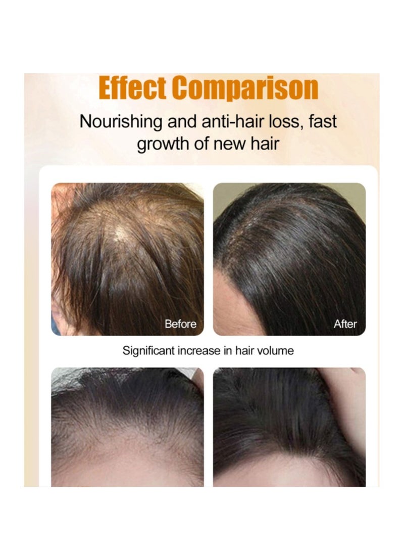 MOOYAM - Herbal Hair Growth Oil And Serum  Dry Scalp Treatment, Hair Thickening Products for Women, Hair Loss Essential Oils For Diffuser 2OZ - Image 1