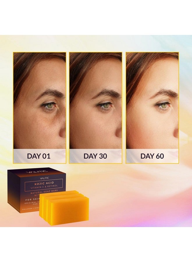 فاليتيك قوالب صابون حمض الكوجيك وفيتامين ج والريتينول مع الكركم للبقع الداكنة والمركب الياباني الأصلي الممزوج بحمض الهيالورونيك والكولاجين وفيتامين هـ (عبوتان) - Image 2