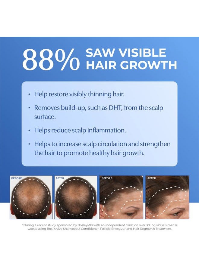 BOSLEYMD Thickening Treatment, Liquid Foaming Treatment to Restore Visibly Thinning Hair 3.4 oz  - Image 4