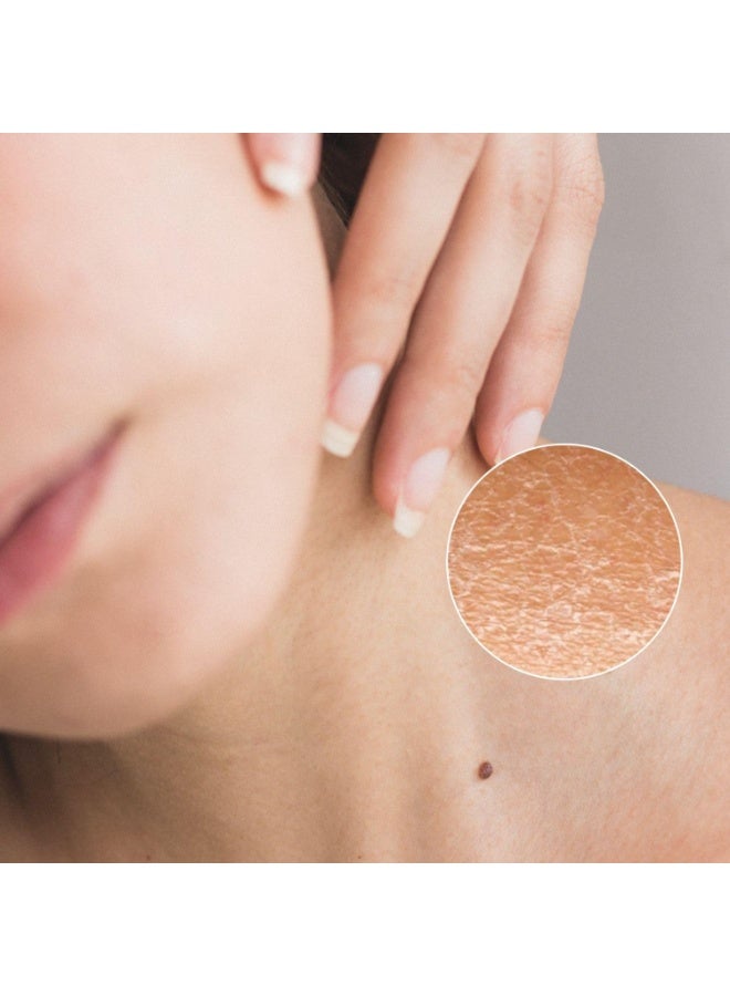 PharmaLine Atopic Hand & Nail Cream 75 ML - Image 4