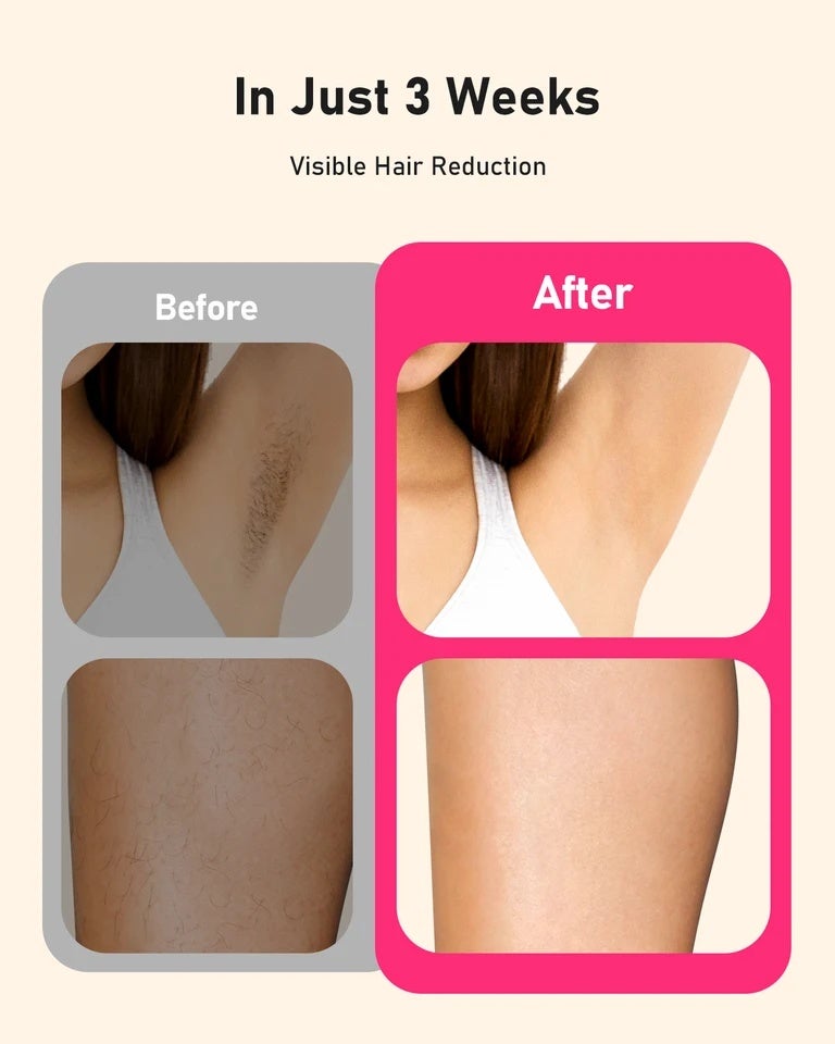 JOOYEE Laser Hair Removal 999999+ Fast flashes 3 In 1 IPL At Home Hair Remover Machine for Women Men Permanent Epilator on Face Body - Image 5