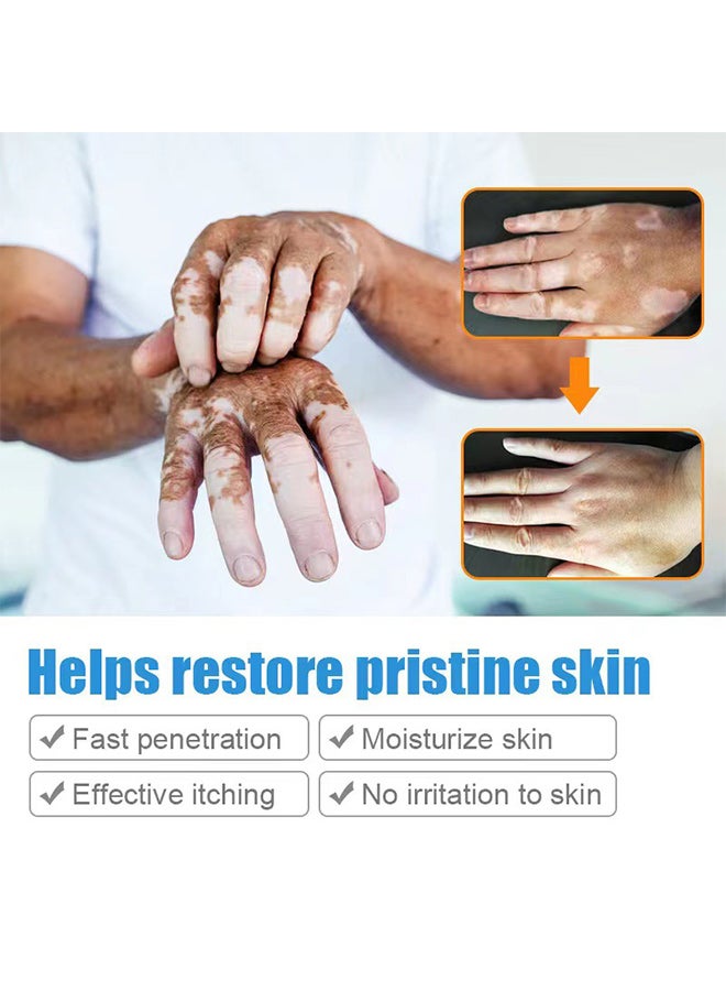 SOL LORA spot care health cream, white spot clean ointment spot pityriasis vitiligo skin external cream - Image 3
