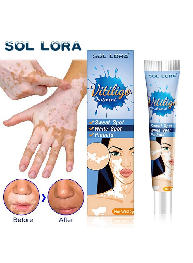 SOL LORA spot care health cream, white spot clean ointment spot pityriasis vitiligo skin external cream - Image 2