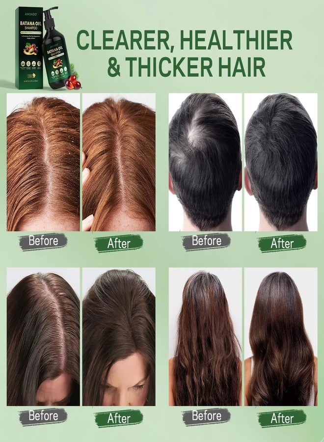 AMOADO Batana Oil Shampoo for Hair Growth, Strengthening, Thickening, Sulfate Free Hair Shampoo for Women & Men with Thinning Hair & Hair Loss, Infused Rosemary, Tea Tree Oil & Mint, 10.15 fl.oz - Image 4