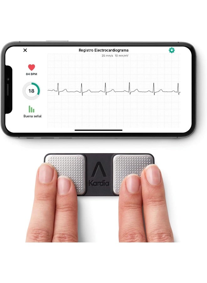 AliveCor KardiaMobile 1-Lead Personal ECG Monitor - Record ECGs at Home - Detects AF and Irregular Arrhythmias - Instant Results in 30 Seconds - Easy to Use - Works with Most Smartphones - Image 5