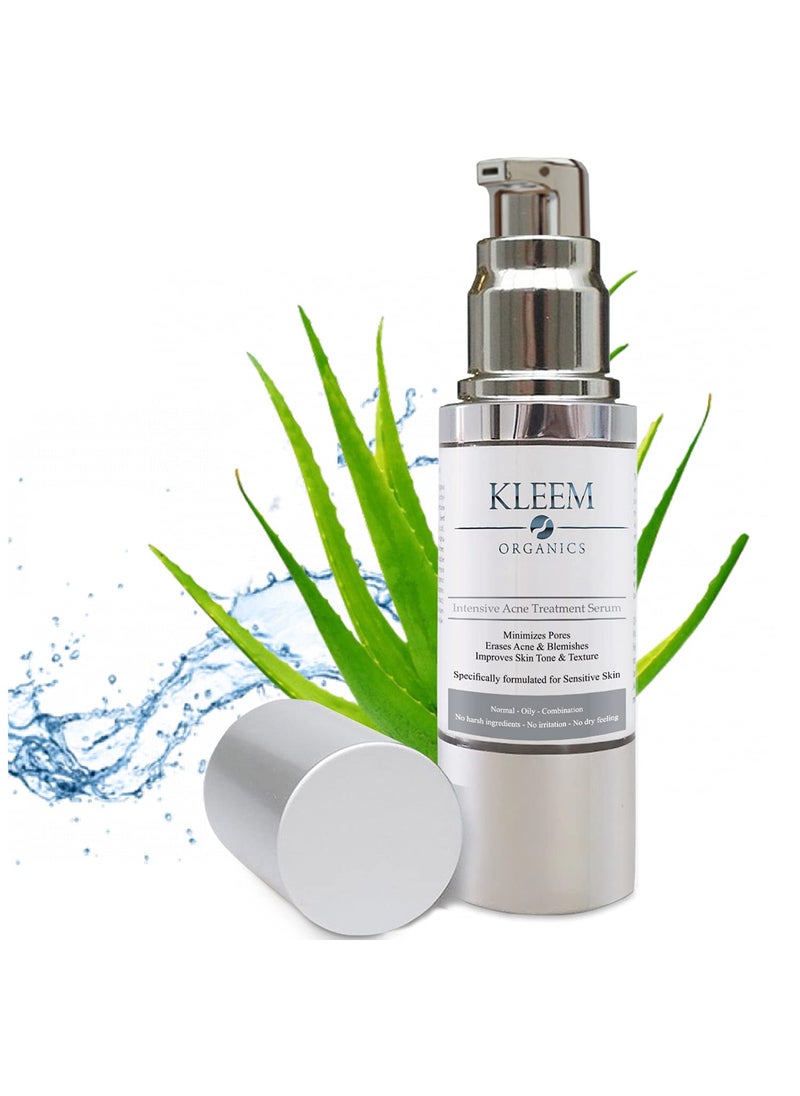 Kleem Organics - Best Acne Treatment for Face with Vitamin C for Men  Women Use Acne Spot Treatment for Face for a Clear  Fresh Skin without Breakouts Redness Blemishes or Acne Scars Results in 4 Weeks  1 Fl Oz - Image 1