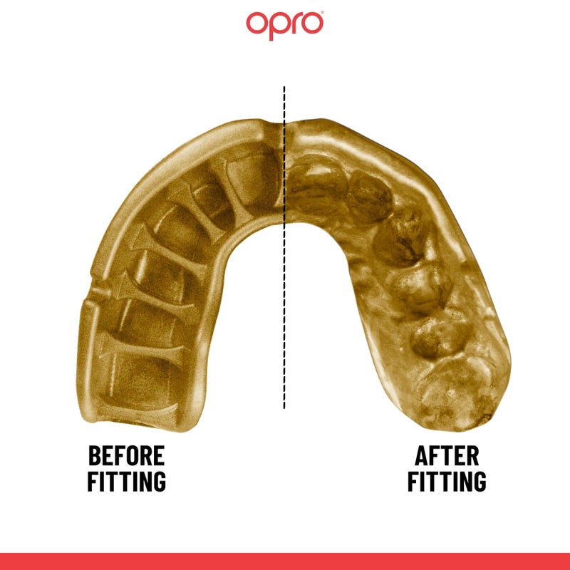 OPRO Gold Level Mouth Guard - Moldable Mouthguard with Premium Comfort Fit, and Multi-Layer Protection for Boxing, MMA, Rugby, Hockey, and Football Mouthpiece â€“ Includes Case (White/Gold, Adult) - Image 4