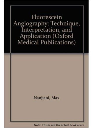 Fluorescein Angiography: Technique, Interpretation and Application - pzsku/Z3E34677FB5EEC236E2F3Z/45/_/1727772694/7a12a8a1-023a-4919-b342-2523a6ba8a16