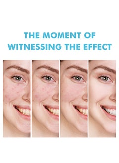 MOOYAM Salicylic Acid Remove Acne Gel-Rapid Action Acne Spot Treatment for Face Closure & Acne Dots, Premium Acne Scar Gel & Pimple Remover 20g  - Image 4