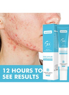 MOOYAM Salicylic Acid Remove Acne Gel-Rapid Action Acne Spot Treatment for Face Closure & Acne Dots, Premium Acne Scar Gel & Pimple Remover 20g  - Image 1