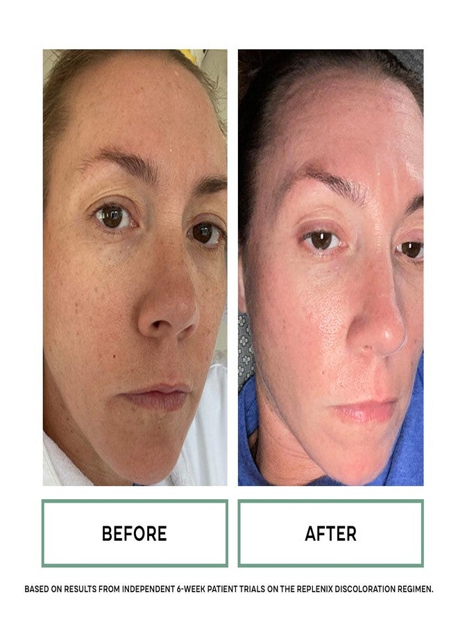 Replenix Pigment Correcting Brightening Cream, Medical-Grade Hydrating Face Moisturizer for Skin Discoloration (1 oz) - Image 5