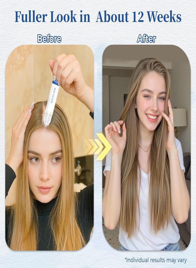 Gluvelessia Hair Growth Serum Roll On with Rosemary for Thicker, Fuller Hair Appearance - Image 4
