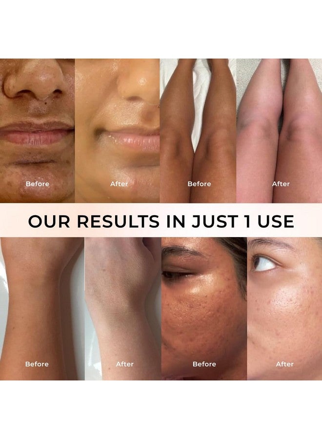 Niconi نكوني تان فانيش جلوتا-كوجيك مقشر البشرة | إزالة تان فورية وبشرة متألقة | مدعوم بحمض الكوجيك والجلوتاثيون | مثالي لجميع أنواع البشرة | يخفف من آثار الشمس | 180 جرام - Image 4