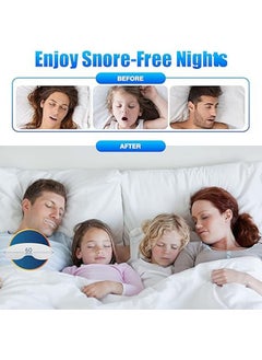 General Sleep patches, Mouthband anti-snoring, 90 sleep patches, Anti-snoring stickers for the development of deep sleep, prevent mouth opening, maintain face shape - 90 pieces  - Image 3