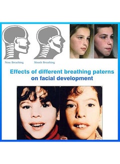 General Sleep patches, Mouthband anti-snoring, 90 sleep patches, Anti-snoring stickers for the development of deep sleep, prevent mouth opening, maintain face shape - 90 pieces  - Image 5
