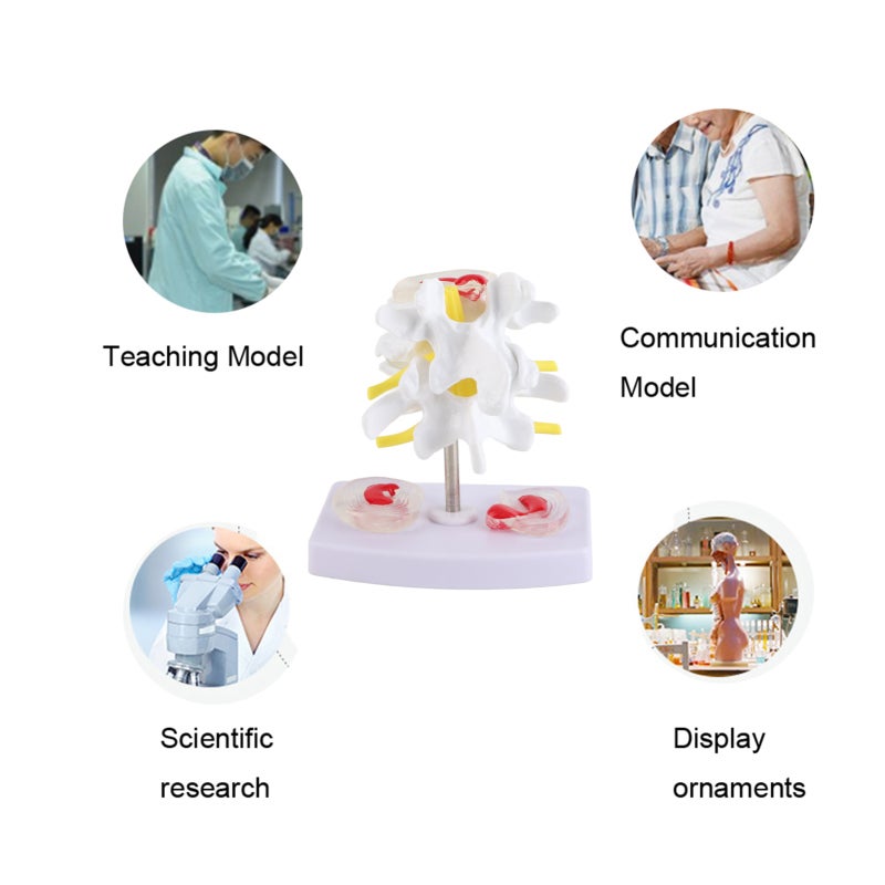 Human Spine Model: 1 Anatomical Lumbar Disc Herniation Model With 2 Diseased Intervertebral Discs Spinal Nerves - Base Mounted Vivid Detailed Structure For Medical Training Doctor Patient Communicatio - Image 4