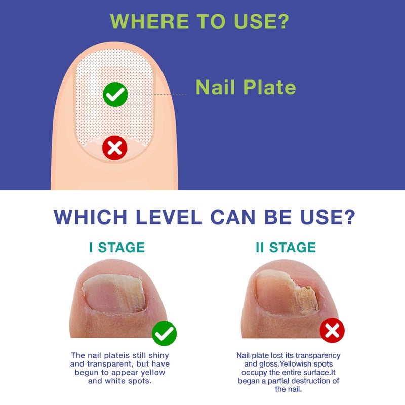 Dr. Luke Nail Repair Liquid, Nail & Cuticle Care for Healthy-Looking Nails, 1 oz (Packaging May Vary) - Image 3