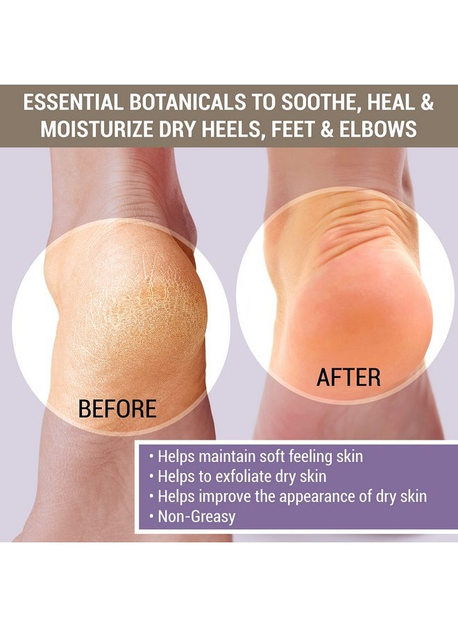 TriDerma - Cracked & Crusty™ Healthy Foot Cream Moisturizes Softens And Heals Dry Feet Cracked Heels And Dry Elbows With Salicylic Acid Urea Shea Butter Ap4 Aloe And Vitamins 4.2 Ounces - Image 1