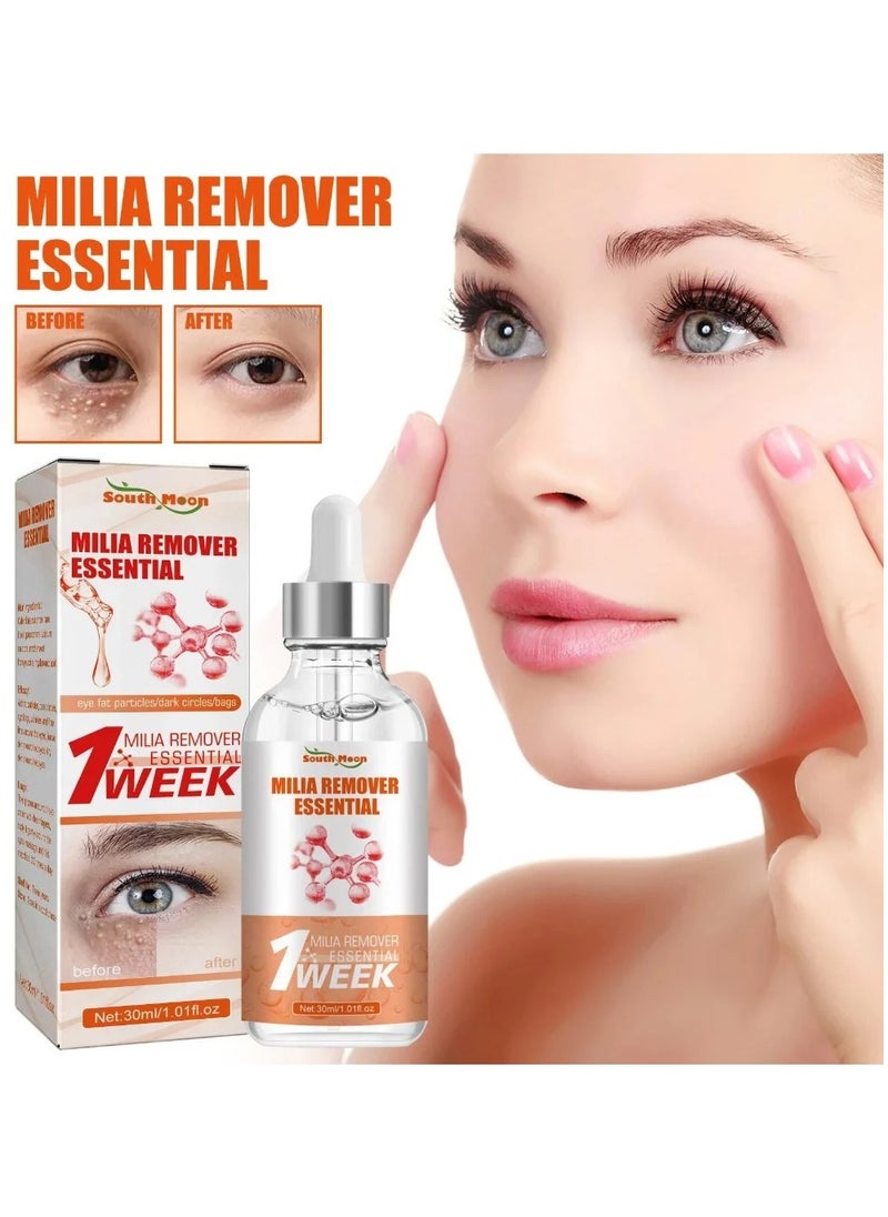 SOUTH MOON - South Moon 30ML Milia Remover Essential Eye Serum Effective Removes Fat Granules Eye Bags Anti-Particles Puffiness Improve Dark Cicle - Image 1