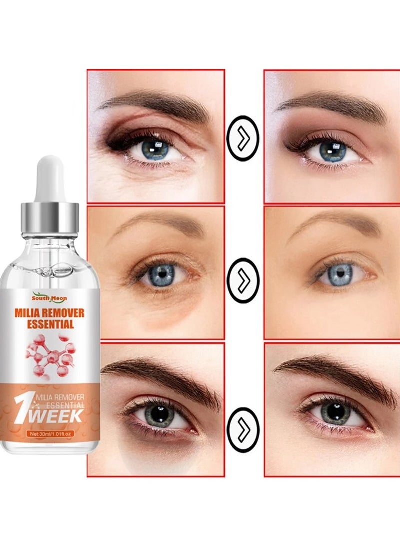 SOUTH MOON - South Moon 30ML Milia Remover Essential Eye Serum Effective Removes Fat Granules Eye Bags Anti-Particles Puffiness Improve Dark Cicle - Image 1