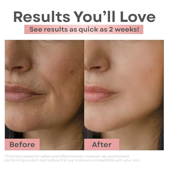 Clear Essence Skin Lightening Serum 1.7oz, Brightening Vitamin C for Face, Dark Spot Remover, Anti Aging, Hyperpigmentation & Acne Scar Correcting Serum - Image 3