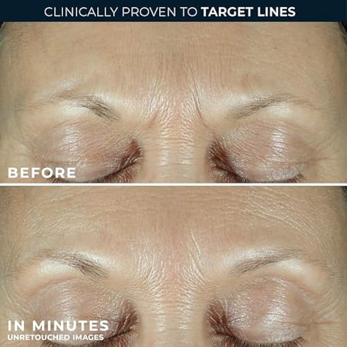 RoC Derm Correxion Fill + Treat Advanced Retinol Serum, Wrinkle Filler Treatment with Hyaluronic Acid for Crow's Feet, 11 Wrinkles, & Laugh Lines, (.5 fl oz) with Retinol Packette (Packaging May Vary) - Image 5