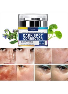 Dark Spot Remover for Face Hyperpigmentation Treatment. Dark Spots, Melasma, Freckle, Sun Spots Removal Dark Spot Corrector Cream for Women and Men