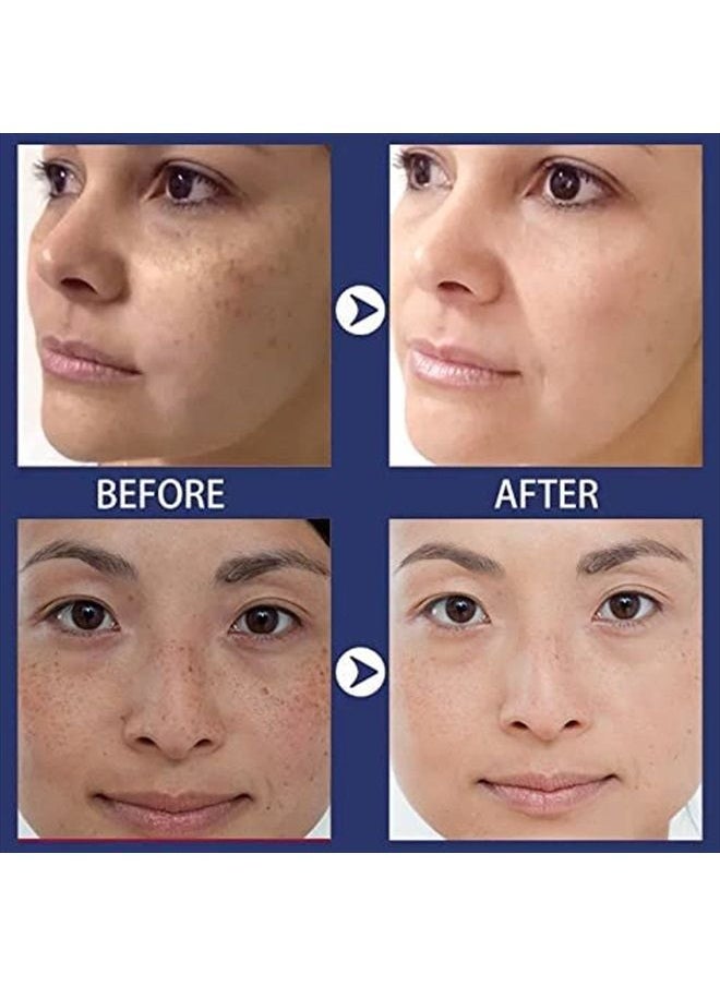Inlifay - Dark Spot Remover for Face Hyperpigmentation Treatment. Dark Spots, Melasma, Freckle, Sun Spots Removal Dark Spot Corrector Cream for Women and Men - Image 1