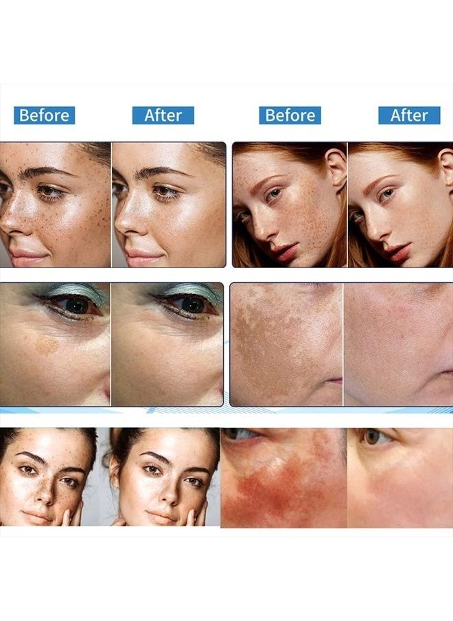 Inlifay - Dark Spot Remover for Face Hyperpigmentation Treatment. Dark Spots, Melasma, Freckle, Sun Spots Removal Dark Spot Corrector Cream for Women and Men - Image 1