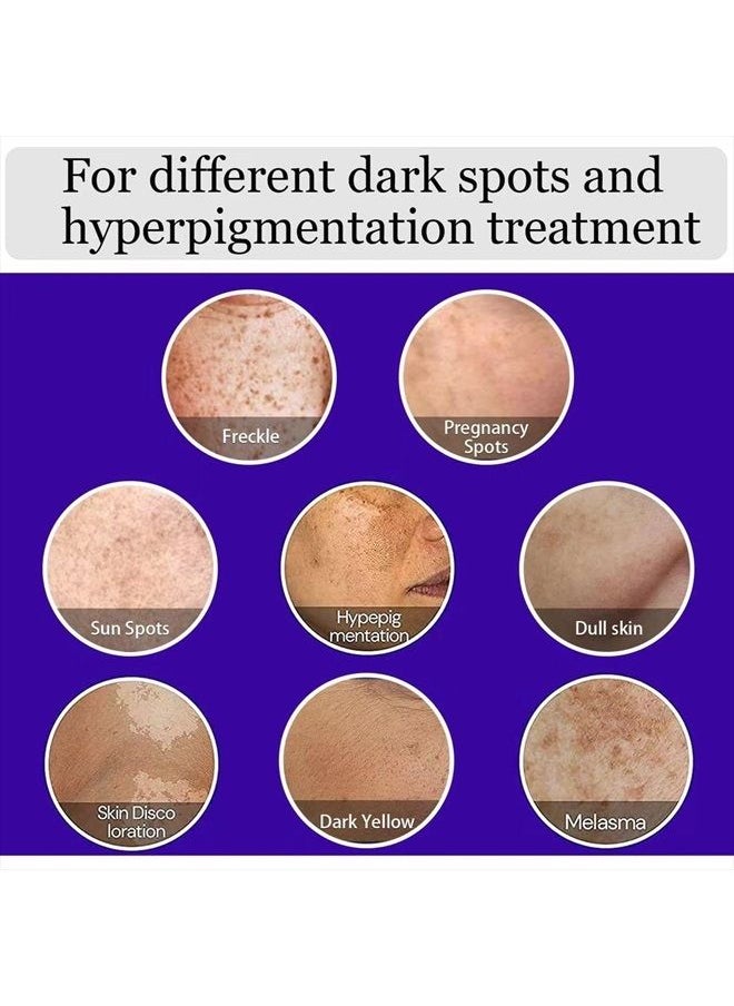Inlifay - Dark Spot Remover for Face Hyperpigmentation Treatment. Dark Spots, Melasma, Freckle, Sun Spots Removal Dark Spot Corrector Cream for Women and Men - Image 1