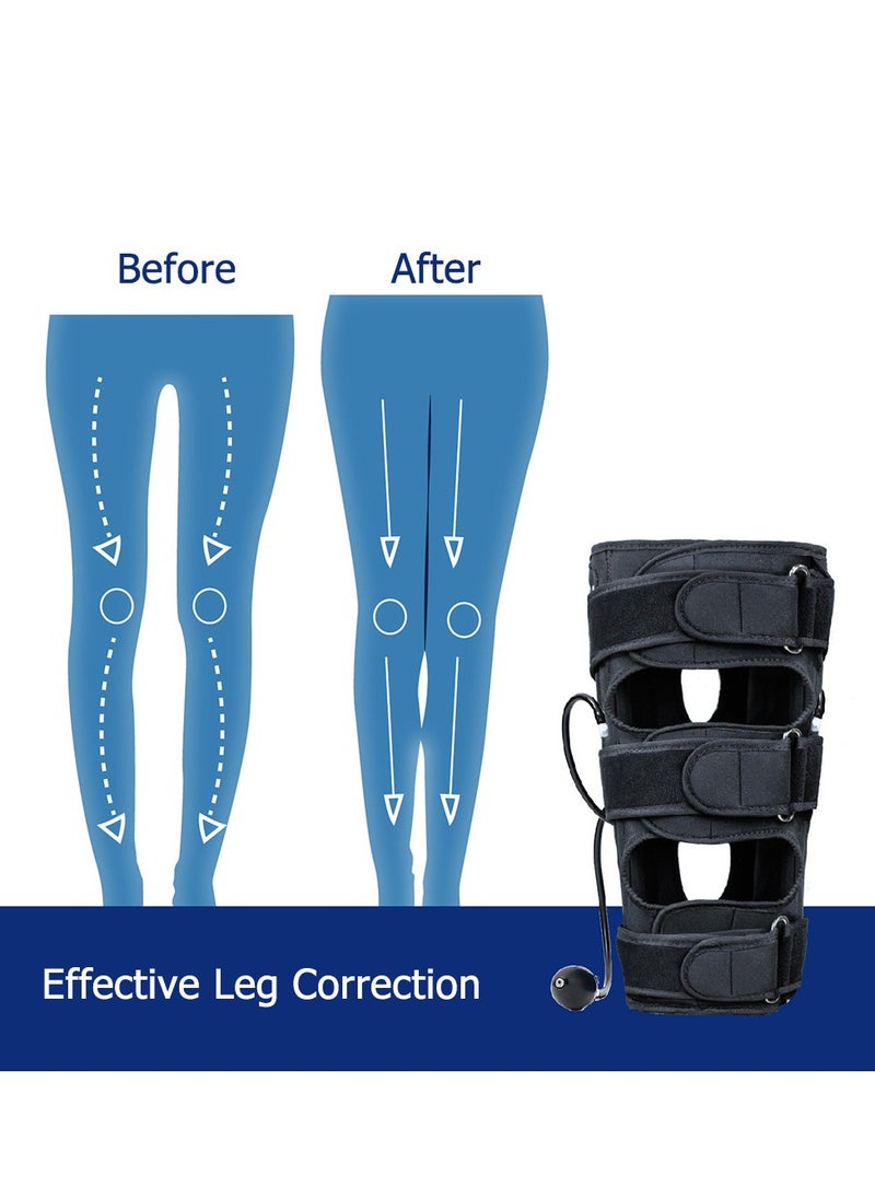 General - O-Shaped Leg Leg Correction Belt Leggings Belt For Adults And Children X-Shaped Leg Bow-Leg Leg Corrector - Image 1