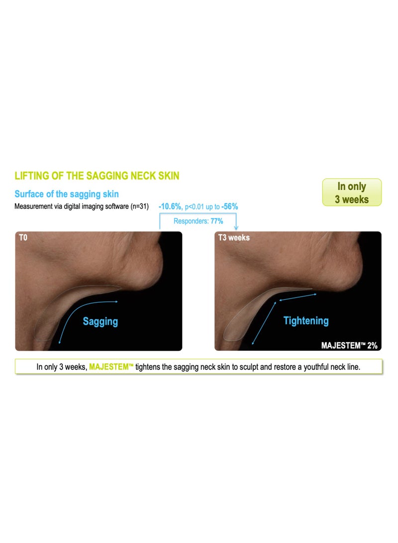 Neue Supreme Recharge Serum - Image 5
