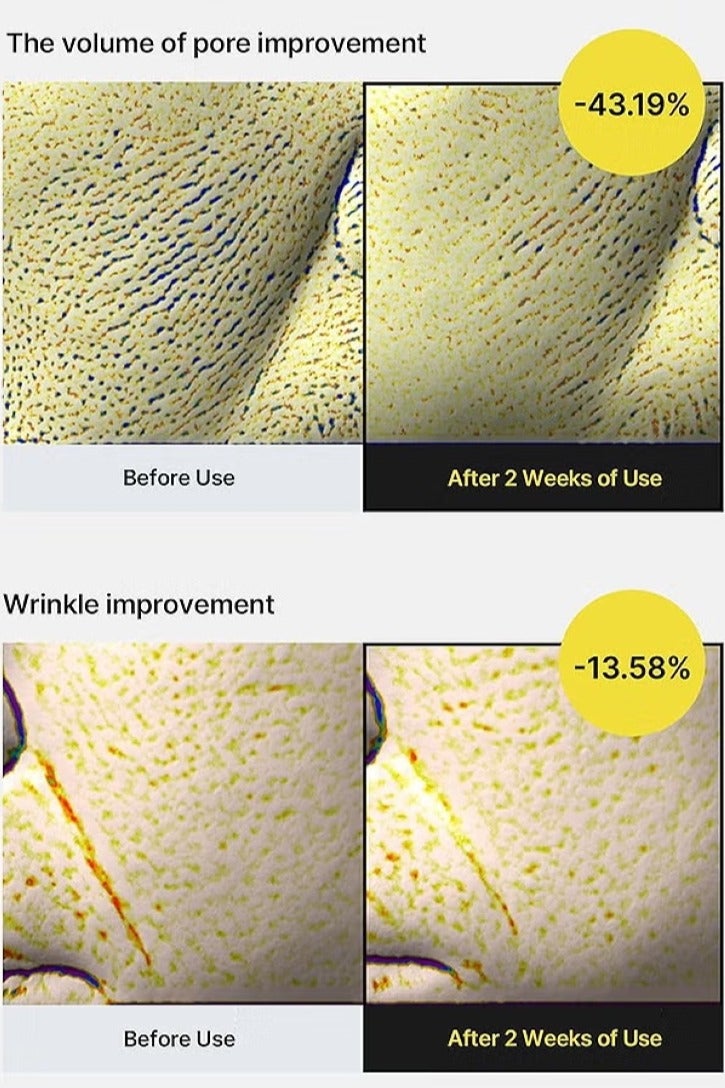 سيليماكس سيروم سيليماكس ذا فيتا أ ريتينول شوت لشد البشرة | مع ريتينول فيتامين أ النقي، وببتيد، ومُقلل للمسام، ومُضاد للتجاعيد والخطوط الدقيقة، لبشرة مشدودة، 30 مل - Image 5