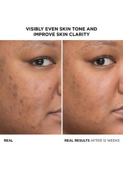 IT COSMETICS IT Cosmetics Bye Bye Dark Spots 4% Niacinamide Serum - Visibly Reduces Dark Spots & Improves Skin Clarity In 8 Weeks - Facial Serum with 1% Ethyl Vitamin C - For All Skin Types - 1 Fl. Oz  - Image 2