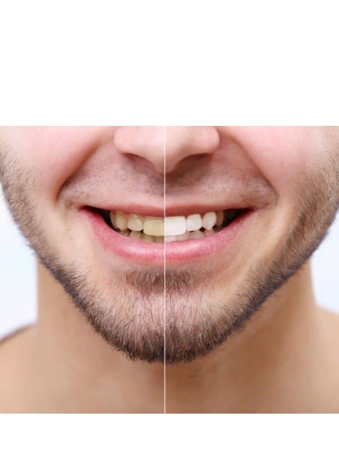 WELZIAD - Tooth Whitening Strips Mint Flavour Box of 14 pieces and Free Tooth Wipes - Image 1
