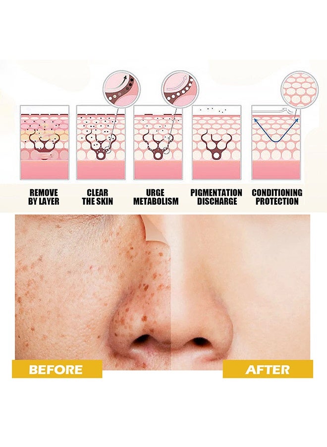 القمر الغربي ممحاة البقع الداكنة تونر الكركم - مصحح الحبر 100 مل تونر الوجه للبشرة المعرضة لحب الشباب مزيل البقع الداكنة لتونر الوجه المرطب للوجه للنساء - Image 3