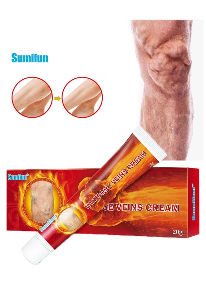 Sumifun Varicose Veins Cream 20g, Phlebitis Spider Pain Relief Balm, Relieve Swelling and Pain, Improve Blood Circulation, Venous Health Ointment  - Image 1